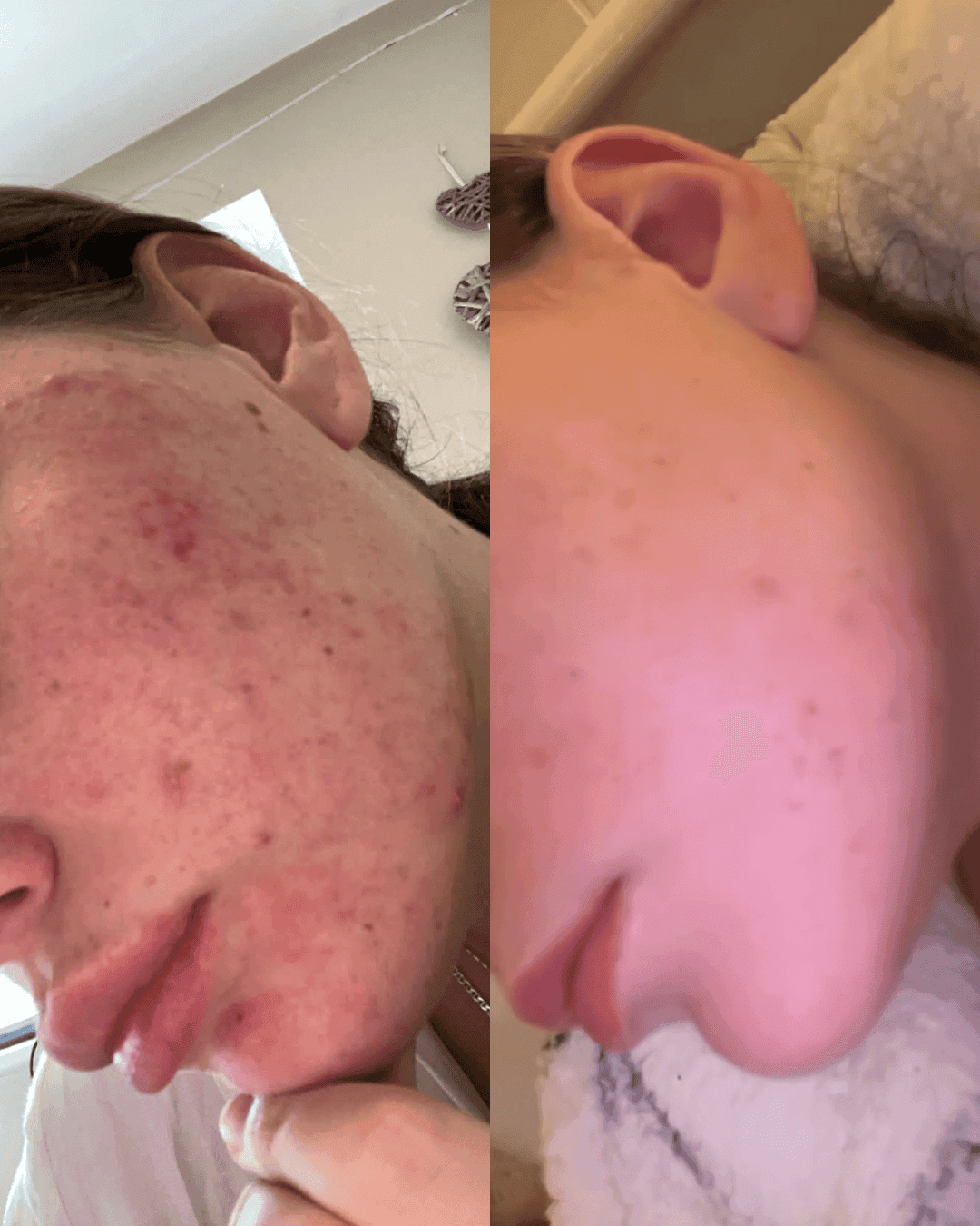 Skin transformation before and after