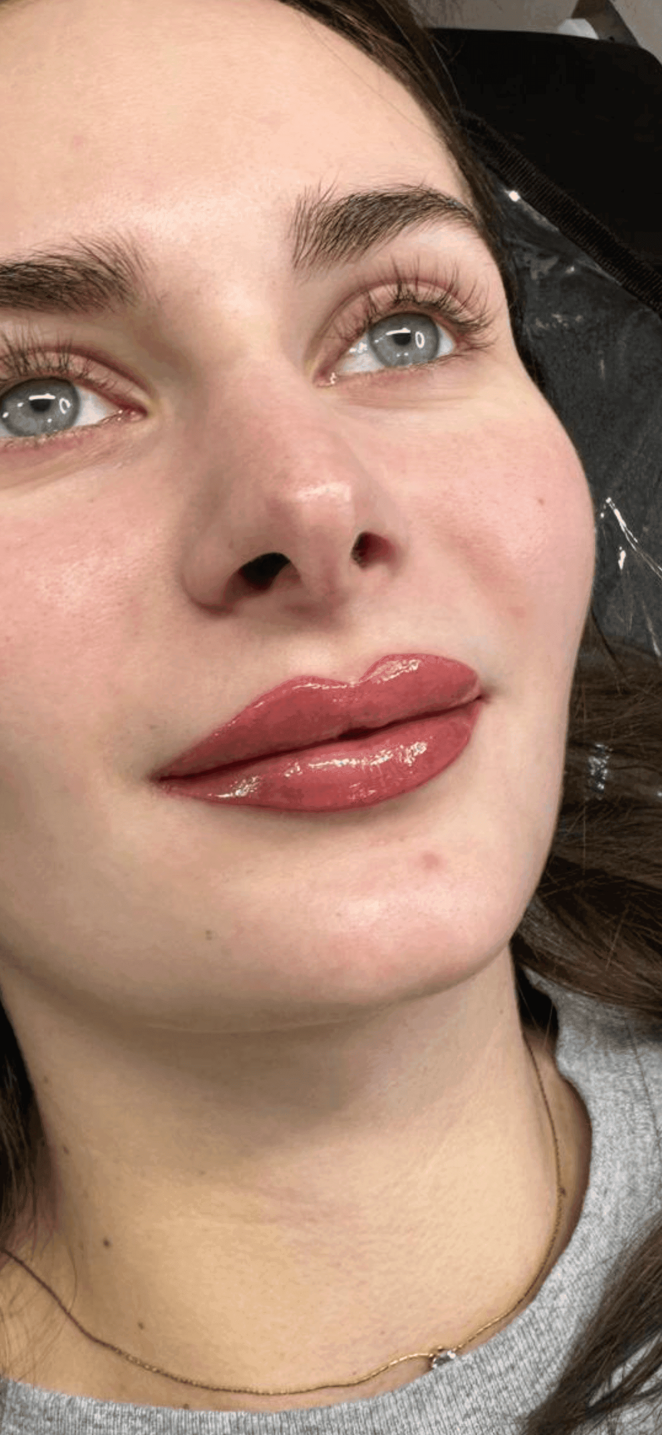 Enhanced lips treatment result