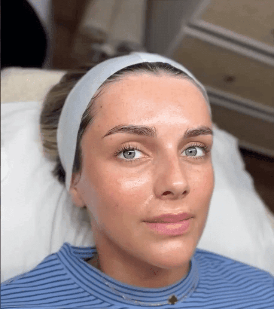 Glass skin facial treatment